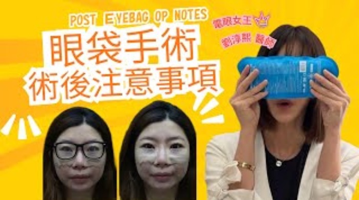 電眼女王劉淳熙醫師爲大家詳細講解眼袋手術後,每個階段恢復狀況, 並把各種應注意事項-有系統且條列式的解說!